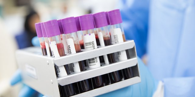 Im letzten Jahr wurden 7000 Campylobacteriose-Fälle und 1500 Salmonellose-Fälle gemeldet. (Bild Ahmad Ardity/pixabay)