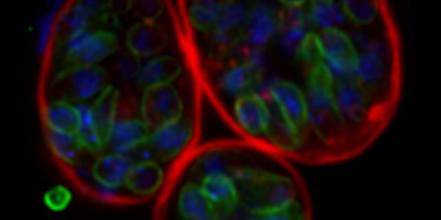 Drei Zysten wie sie im Gehirn von chronisch infizierten Tieren und dem Menschen vorkommen. (Bild UZH)