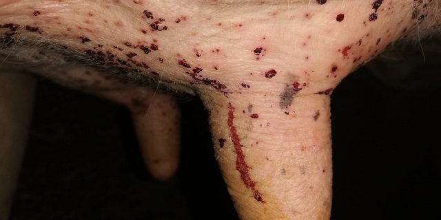 Krustenbedeckte Blutpunkte beim abendlichen Melken weisen auf den Befall durch die Kriebelmücke hin. (Bilder Reto Betschart)
