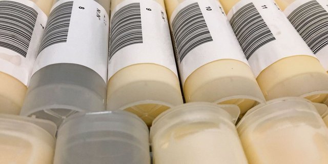 Was sagen Milchmenge- und inhaltsstoffe über die Versorgung der Kuh aus?