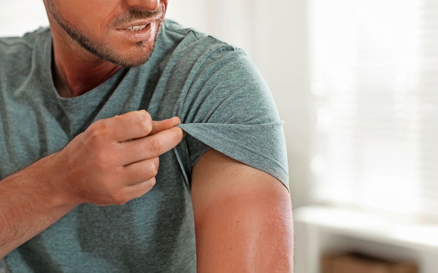 Ein Sonnenbrand ist nicht nur einfach lästig. Er sollte daher möglichst vermieden werden.