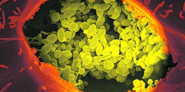 Das auf dem Bild stark vergrösserte Bakterium Coxiella brunetii kann sowohl Menschen als auch Tiere befallen. (Bild Georg Graf von Westphalen)