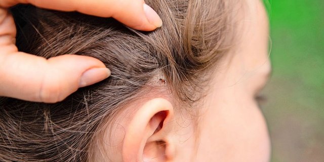 Kinder sind besonders gefährdet, von einer Zecke gestochen zu werden. Sie sollten daher nach jedem Spieltag draussen von Kopf bis Fuss abgesucht werden.